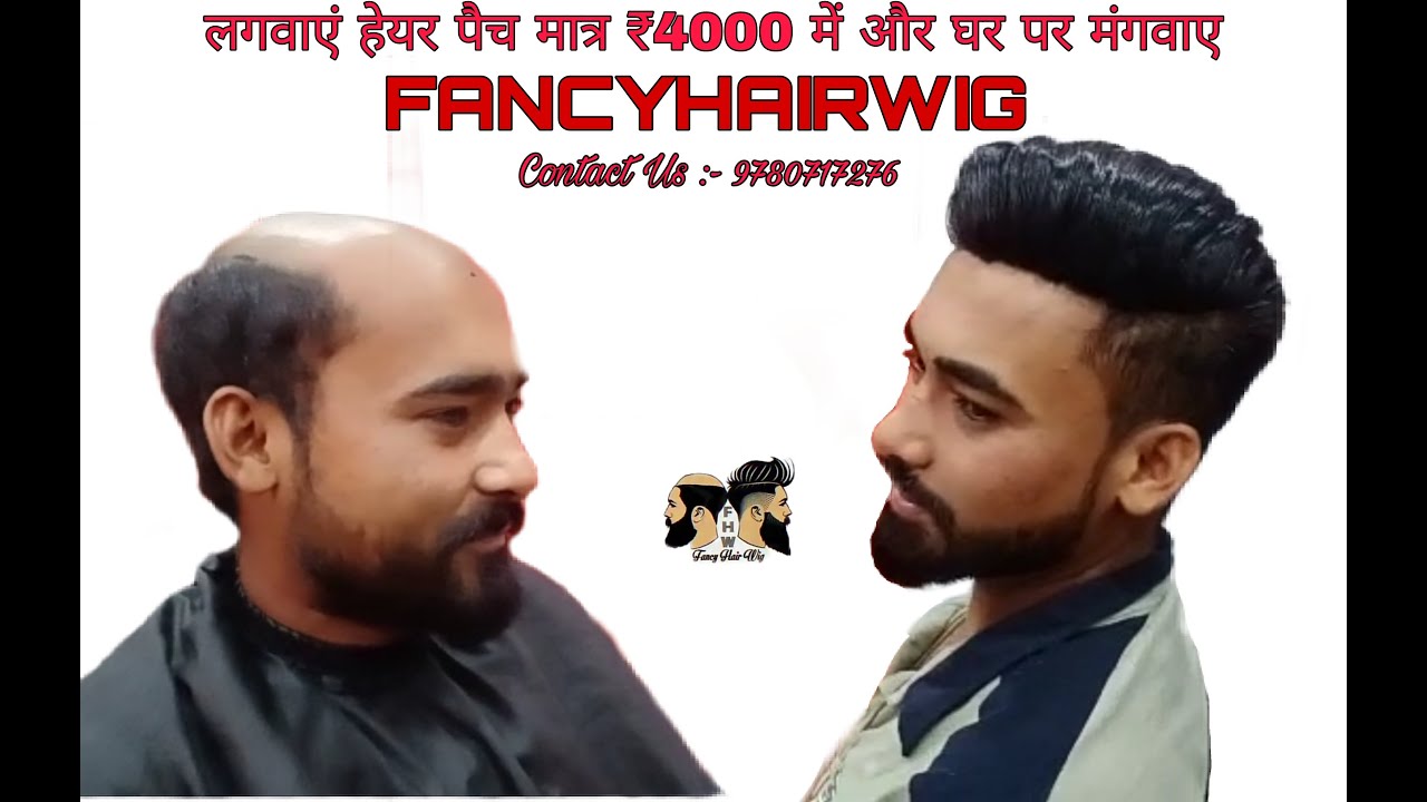 hair patch wig and service in Pathankot Jalandhar Punjab India