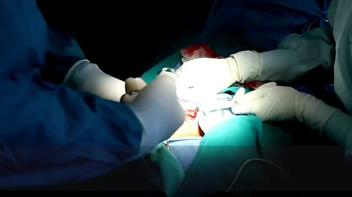 25 at 25: Transforming treatment for gastroesophageal cancer