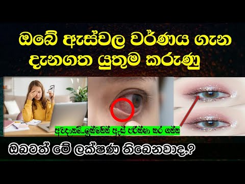 ඇස් වල වර්ණය හා ඒ මගින් කියවෙන චරිත ලක්ෂණ | The color of the eyes and the character traits they read