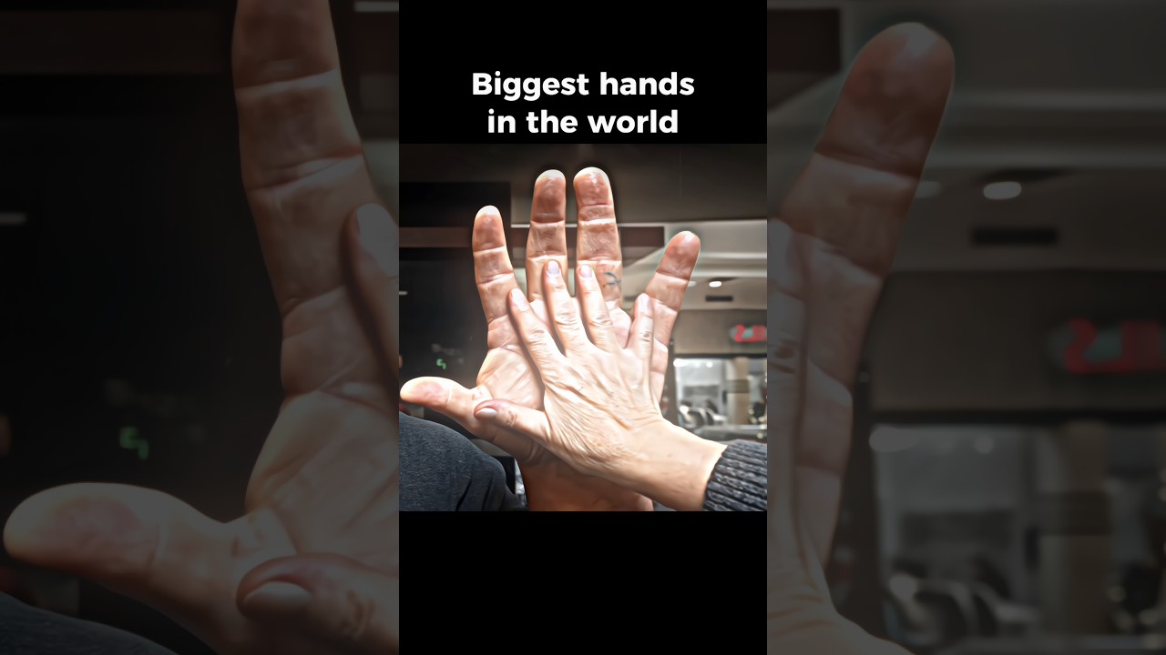 Biggest hand in the world vs Normal people's 
