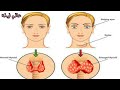 تحميل أغنية رقية الغدة الدرقية Mp3 Mp4
