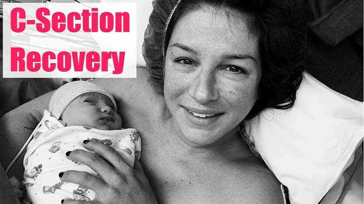 MY C-SECTION RECOVERY | Shenae Grimes Beech