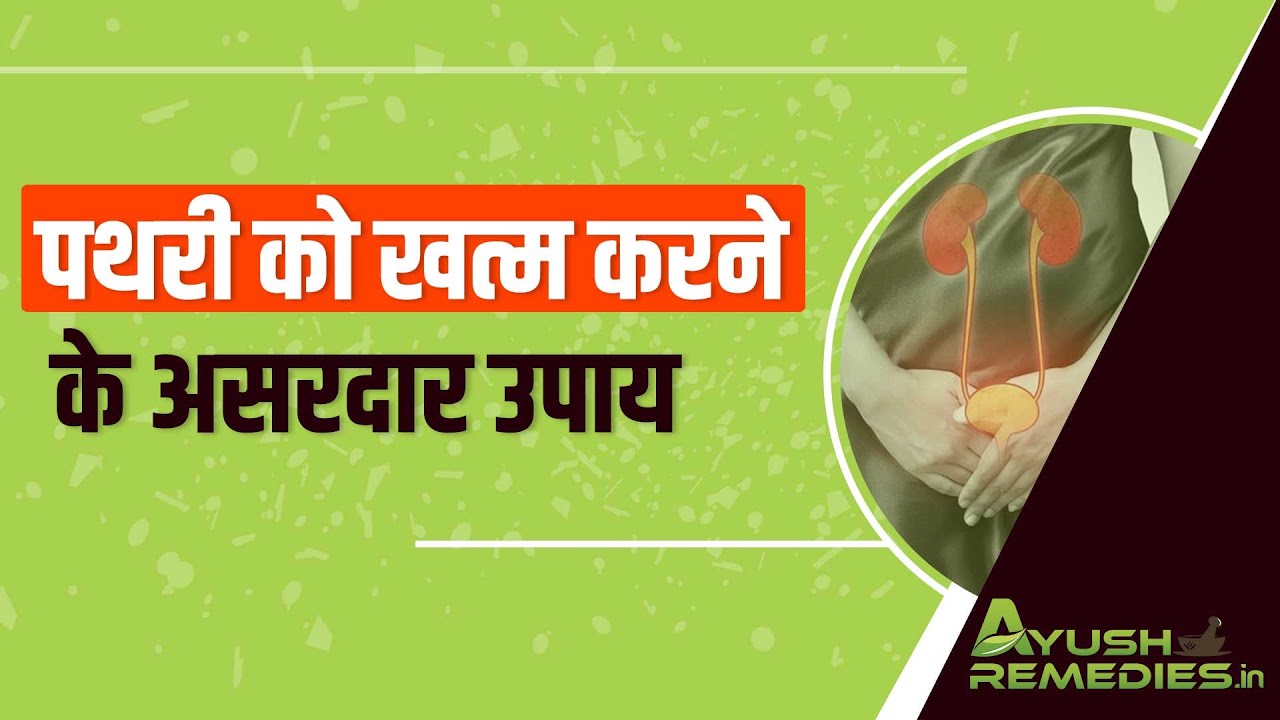 पथरी को खत्म करने के असरदार उपाय How to Remove Kidney