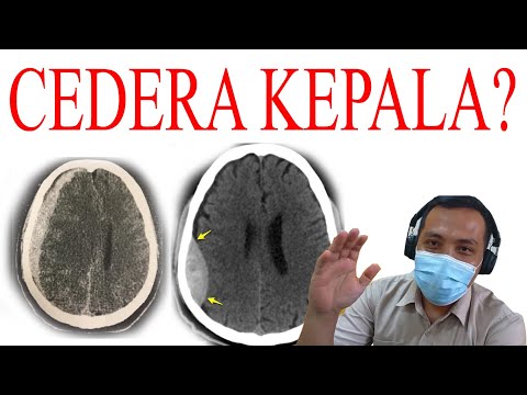 Video: Setiap Dua Puluh Kasus Bunuh Diri Dapat Disebabkan Oleh Cedera Otak Traumatis - Pandangan Alternatif