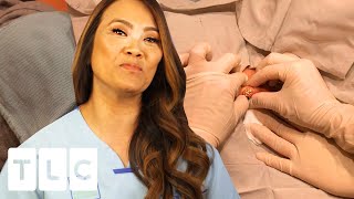 “Why Does My Cyst Keep Coming Back”: Dr Lee Removes “Kitty Poop” | Dr. Pimple Popper: This Is Zit