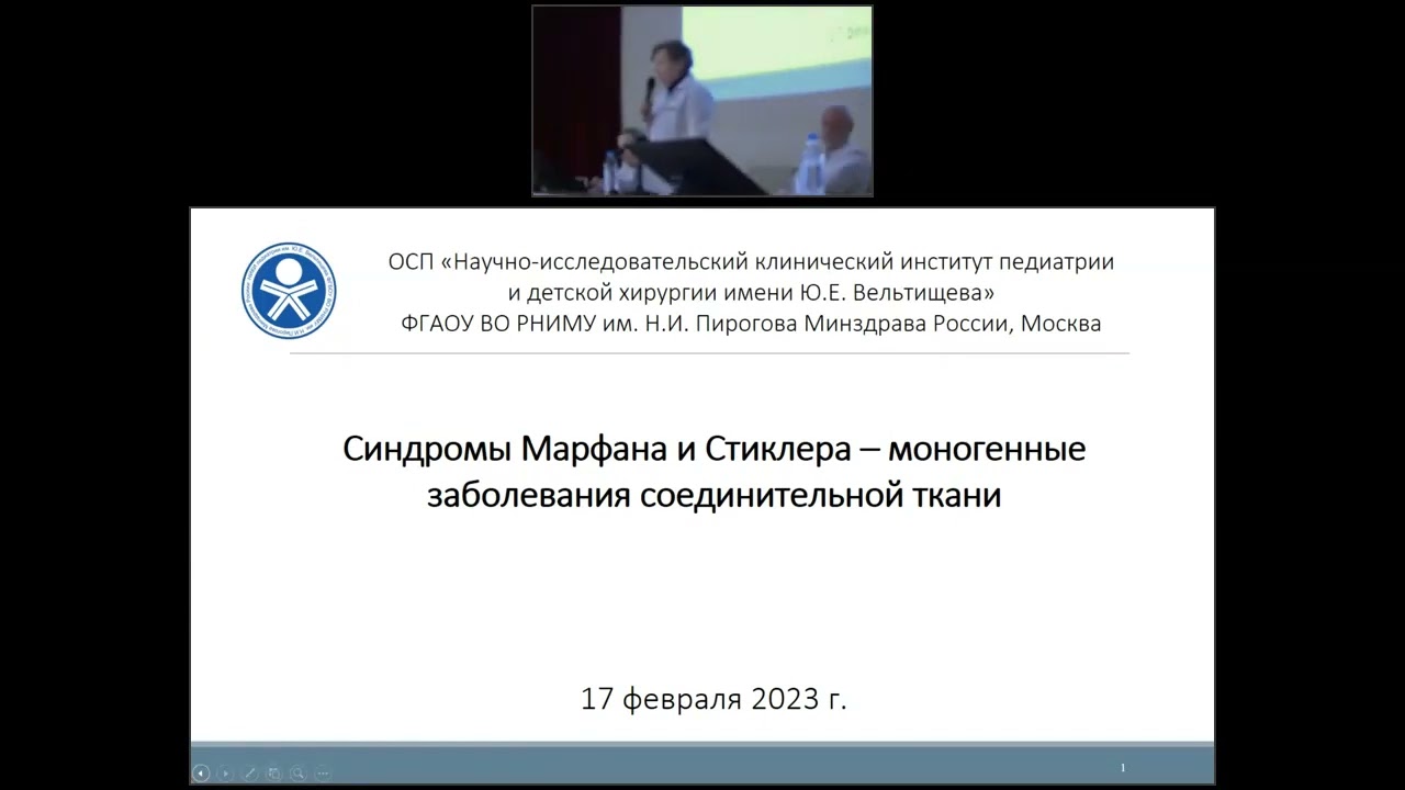 Редкое сочетание моногенных болезней соединительной ткани – синдромов Марфана и Стиклера