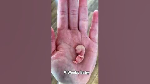 9 Weeks baby playing #unitedstates #baby #9weekspregnency