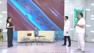 Энг кўп тарқалган ВАРИКОЗ касаллигини қандай даволаш мумкин? | Salomatlik formulasi