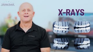 Dental X-Rays Explained