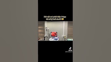 Nội soi đại tràng cắt polyp