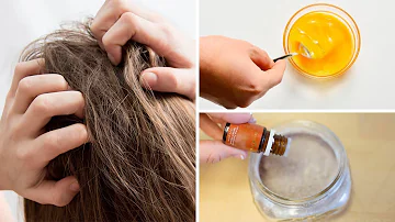 Que remédio tomar para alergia de tinta de cabelo?