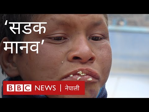 उद्धार गरिएका 'सडक मानव'को अवस्था
