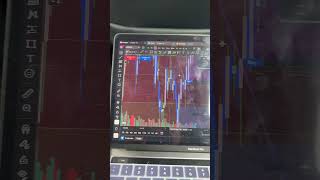 #daytrader #fundedtrader #daytrading #fyp #tradingmotivation #trading