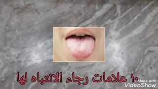 عشرة علامات لمرض السكري المبكره التي لم تكن تعرفها اعرفها لو لم تكن تعرفها من قبل/ ندي علي