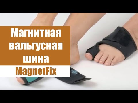 👣 Вальгусная шина Магнит Фикс 🎯 Выпирает кость на ноге где большой палец