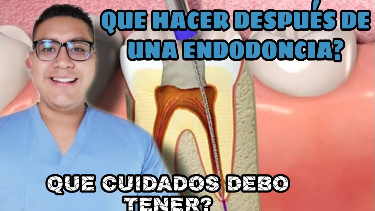 Endodoncia como se hace