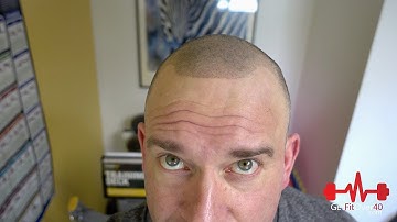 Getting Real Series - SMP Scalp Micropigmentation Sessions 3