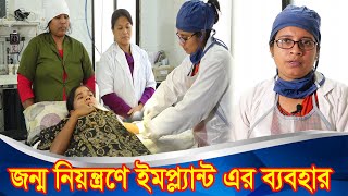 দীর্ঘমেয়াদী ইমপ্ল্যান্ট পদ্ধতি নিন | জন্মনিয়ন্ত্রণে ইমপ্ল্যান্ট | Implant Tips | Doctor Mission