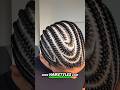 Tight Hairstyles Can Slowly Damage Your Hair
