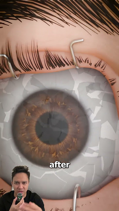 Download lagu Berhenti ngedip = BUTA 😱❓ #helpmemakethismakesense #videoreaction #trendingshorts #shorts #viral