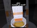 شاهد كيف يتم عمل تحليل الكشف عن المخدرات