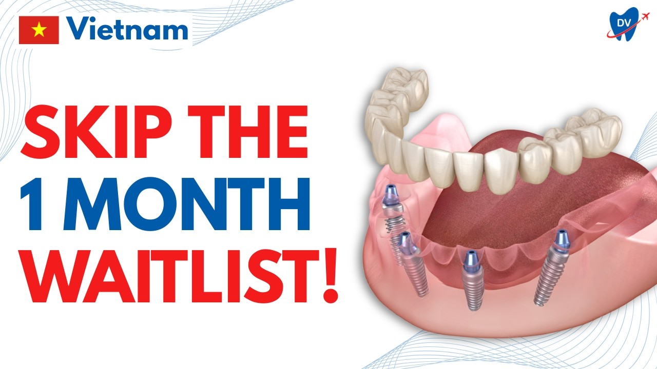 Get Dental Implants in Ho Chi Minh City Instead! (Cost & Process Explained)