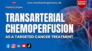 Transarterial Chemoperfusion (TACP) as a Targeted Cancer Treatment in Germany