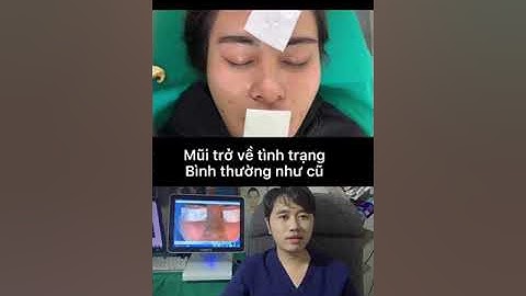 Tháo sụn mũi có trở về bình thường như cũ không