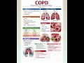 🎯🫁Respiratory Disease Simplified 🩻🩺#shorts #shortvideo @Life_in_ICU_yt 👈Subscribe ✨️🏥🩺
