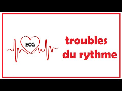 Vidéo: Problèmes De Rythme Cardiaque (complexes Prématurés) Chez Les Chats