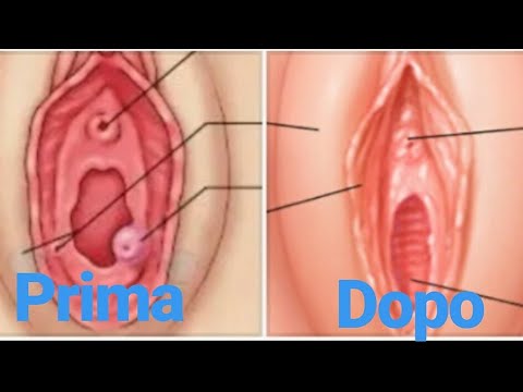 Come stringere la vagina,ed eliminare gli odori