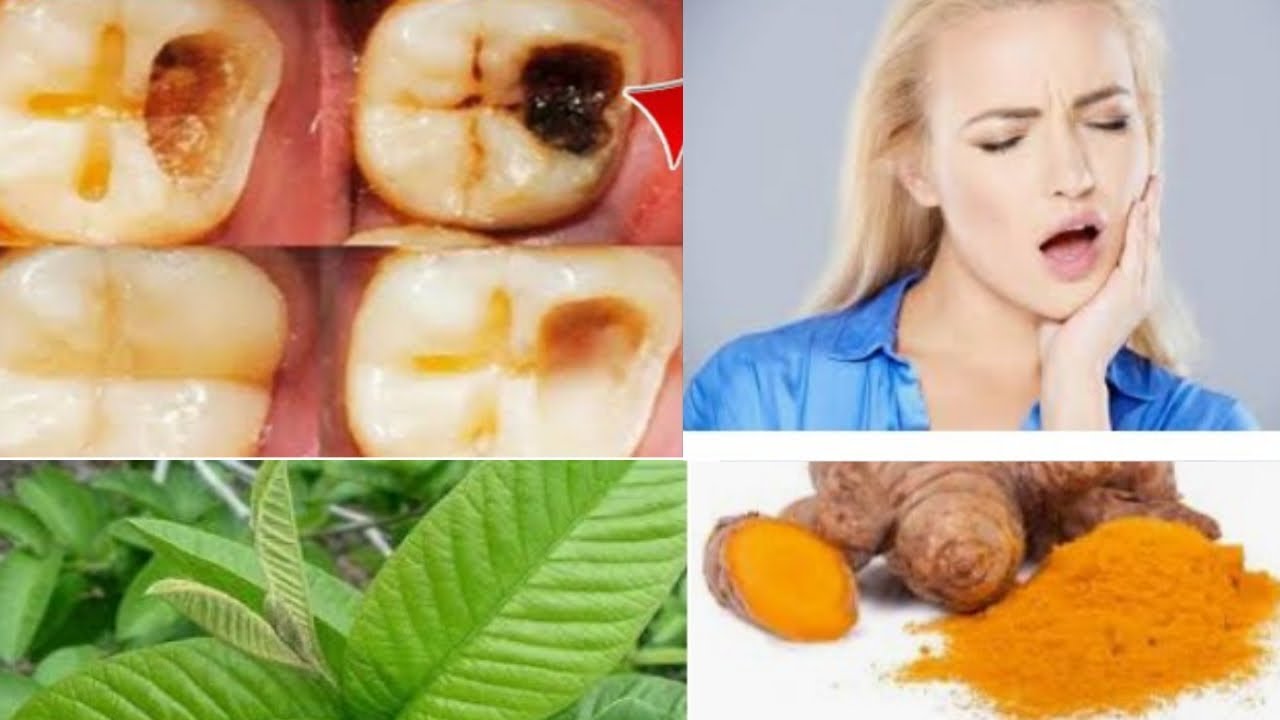 பல் வலி Dental pain relief in Tamil Nighttime teeth pain relief