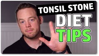 My Top 5 Diet Tips For Tonsil Stones & Dry Mouth