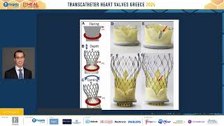 G. Tang | 2. Optimizing TAVI outcomes