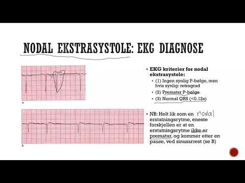 Video: Forskjellen Mellom EKG Og Ekkokardiogram