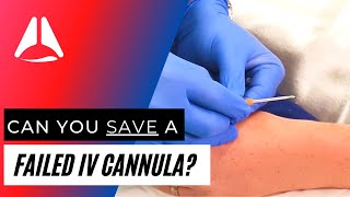 It is possible to safely rescue a failed IV cannula?