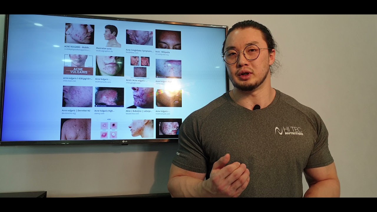 Яаж батганаас салах вэ ? 9-н арга