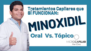¿Es mejor tomar minoxidil por vía oral o tópica?