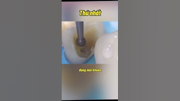#82 Quy trình xử lý răng sâu bằng phương pháp overlay #niengrang #sharing #tips #nhakhoaledong