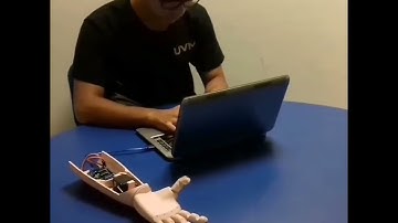 Prótesis robótica impresa en 3D controlada con Arduino y sensor muscular mioeléctrico