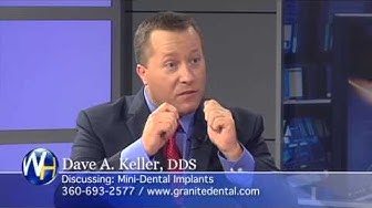 Affordable Dentures And Implants Yakima  : If The Idea Of Having To Wear Dentures For The Rest Of Your Life Makes You From A Comfort And Performance Standpoint, Dental Implants Far Outshine Dentures.