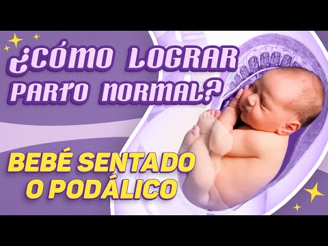 Video: ¿Qué sucede cuando un bebé está de nalgas?