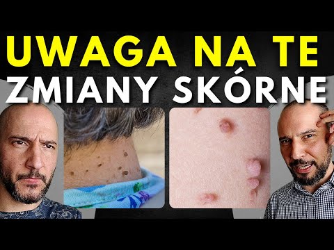 Wideo: 3 sposoby na jasną skórę