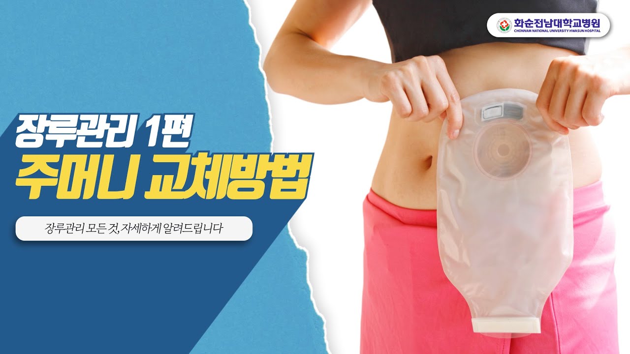 [장루관리 1편] 나혼자 하는 장루 주머니 교체 - YouTube