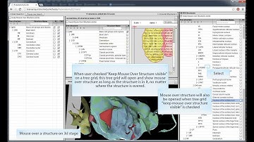 Pubanatomy 3D Tree grid -- 1, Synchronization among tree grids
