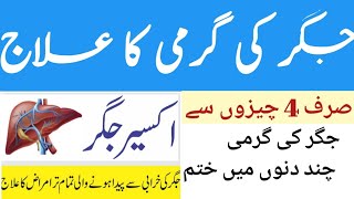 Jigar Ki Garmi Ka Ilaj In Urdu | Liver Swelling Treatment In Urdu | Fatty Liver | Liver Problem