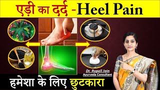 एड़ी का दर्द - Heel Pain || सबसे सटीक इलाज कैसे करे || Fastest Way to Cure Heel Pain