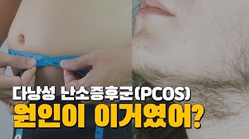 다낭성 난소증후군(PCOS)을 치료하는 느리지만 가장 확실한 방법