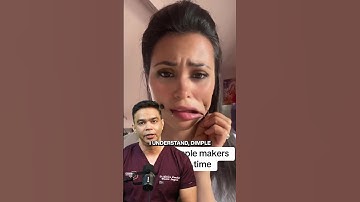 How are dimples formed? Can you get dimples ?