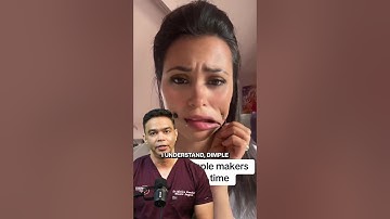 How are dimples formed? Can you get dimples ?